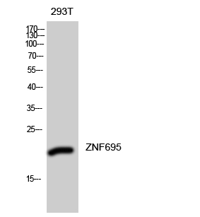 Fig1:; Western Blot analysis of 293T cells using ZNF695 Polyclonal Antibody diluted at 1：2000. Secondary antibody（catalog#：HA1001) was diluted at 1:20000 cells nucleus extracted by Minute TM Cytoplasmic and Nuclear Fractionation kit (SC-003,Inventbiotech,MN,USA).
