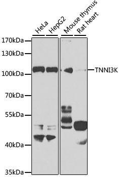 Western blot - TNNI3K Polyclonal Antibody 