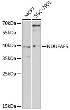 Western blot - NDUFAF5 Polyclonal Antibody 