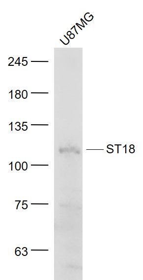 Fig1: Sample:; U87MG(Human) Cell Lysate at 30 ug; Primary: Anti- ST18 at 1/1000 dilution; Secondary: IRDye800CW Goat Anti-Rabbit IgG at 1/20000 dilution; Predicted band size: 115 kD; Observed band size: 115 kD