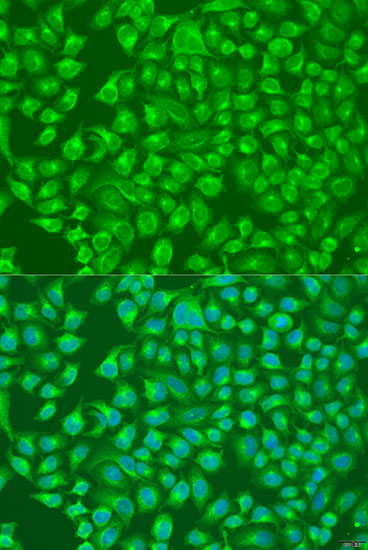 Immunofluorescence - SLC12A6 Polyclonal Antibody 