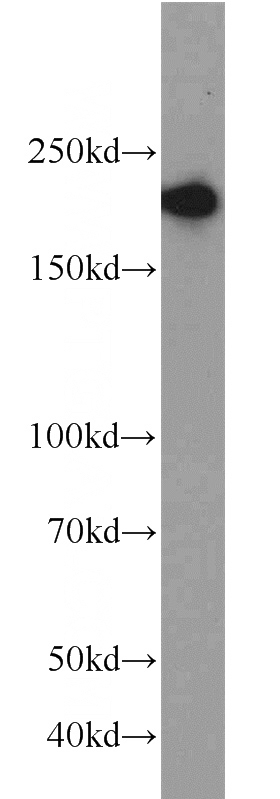 MCF7 cells were subjected to SDS PAGE followed by western blot with Catalog No:114587(RB1CC1 antibody) at dilution of 1:1000