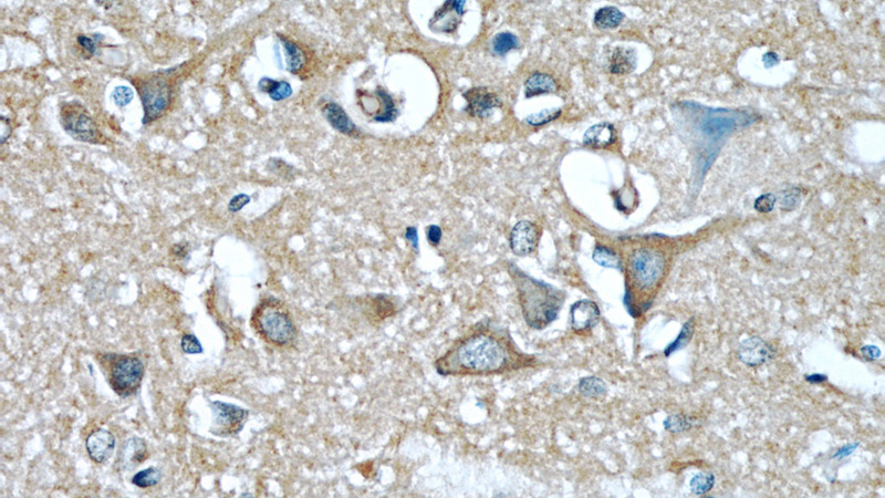Immunohistochemical of paraffin-embedded human brain using Catalog No:107251(EIF3D antibody) at dilution of 1:50 (under 40x lens)