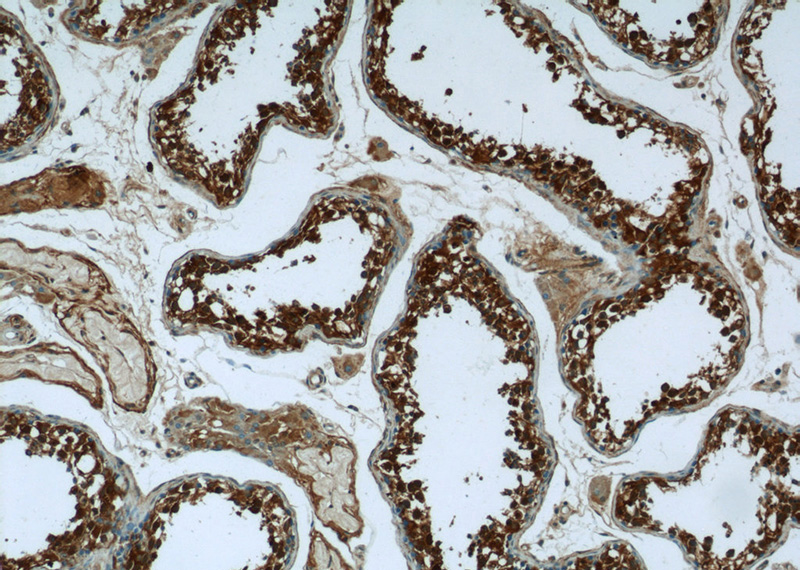 Immunohistochemistry of paraffin-embedded human testis tissue slide using Catalog No:109934(DHX57 Antibody) at dilution of 1:50 (under 10x lens)