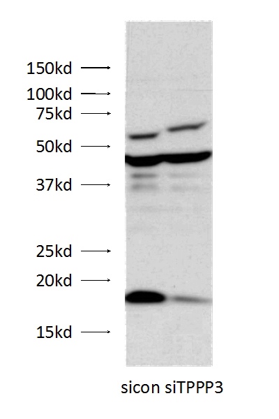 WB result of anti-TPPP3 (Catalog No:116214, 1:500) with HEK-293 cells (siRNA transfected with) by Dr. Yupeng Chen. (Negative control or TPPP3 specific siRNAs were transfected into HEK-293 cells with the final concentration of 20 nM. Forty eight hours after transfection, cells were lysed with RIPA buffer and subjected to SDS PAGE)
