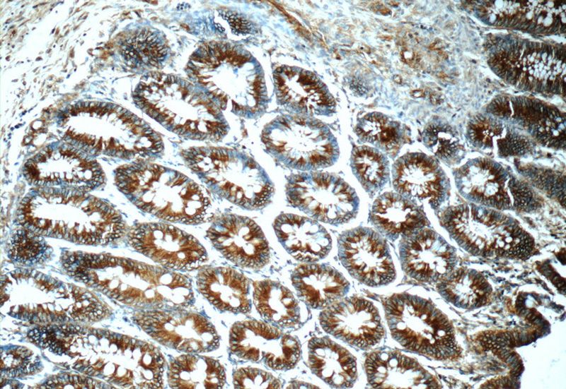 Immunohistochemistry of paraffin-embedded human colon tissue slide using Catalog No:110718(FPGT Antibody) at dilution of 1:50 (under 10x lens)