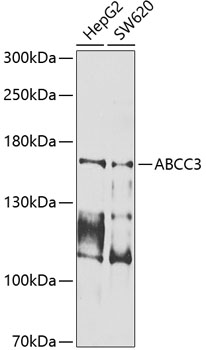 Western blot - ABCC3 Polyclonal Antibody 
