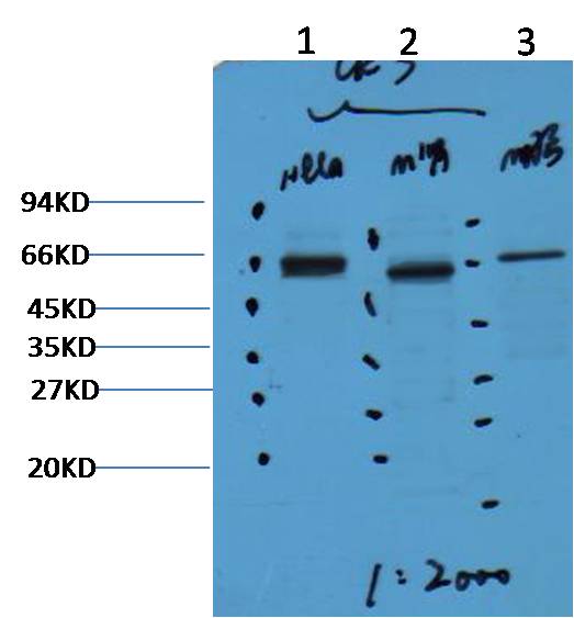 Western blot analysis of 1) Hela, 2) Mouse Kidney, 3) Mouse Brain, diluted at 1:2000.