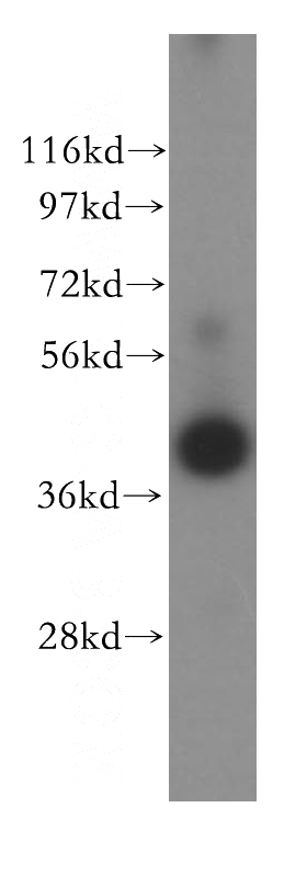 Jurkat cells were subjected to SDS PAGE followed by western blot with Catalog No:111734(IL2RG antibody) at dilution of 1:400