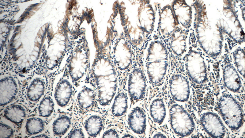 Immunohistochemistry of paraffin-embedded human colon tissue slide using Catalog No:113175(C9orf127 Antibody) at dilution of 1:50 (under 10x lens)