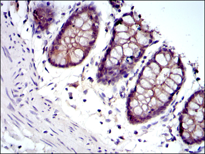 Immunohistochemical analysis of paraffin-embedded rectum tissues using JUP mouse mAb with DAB staining.