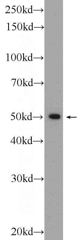 HepG2 cells were subjected to SDS PAGE followed by western blot with Catalog No:116944(ZNF101 Antibody) at dilution of 1:600