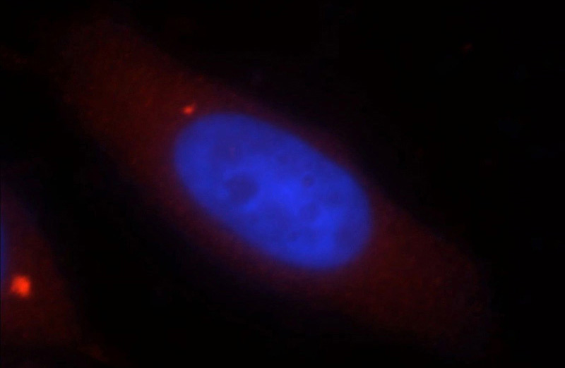 Immunofluorescent analysis of MCF-7 cells, using DNASE1L1 antibody Catalog No:109958 at 1:25 dilution and Rhodamine-labeled goat anti-rabbit IgG (red). Blue pseudocolor = DAPI (fluorescent DNA dye).