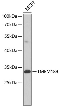 Western blot - TMEM189 Polyclonal Antibody 