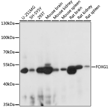 Western blot - FOXG1 Polyclonal Antibody 