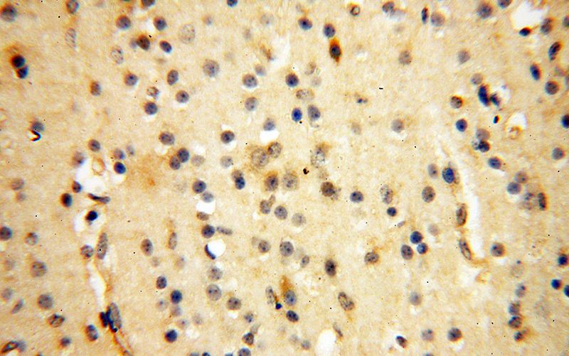 Immunohistochemical of paraffin-embedded human brain using Catalog No:113618(PC5 antibody) at dilution of 1:200 (under 40x lens)
