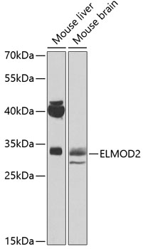 Western blot - ELMOD2 Polyclonal Antibody 