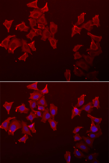 Immunofluorescence - LECT1 Polyclonal Antibody 