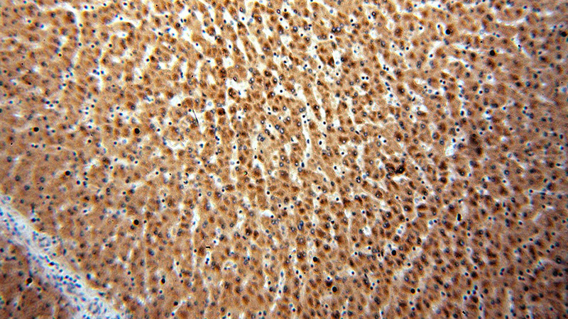 Immunohistochemical of paraffin-embedded human liver using Catalog No:116868(WDR45 antibody) at dilution of 1:50 (under 10x lens)