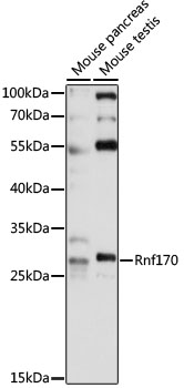 Western blot - Rnf170 Polyclonal Antibody 