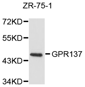 Western blot - GPR137 Polyclonal Antibody 