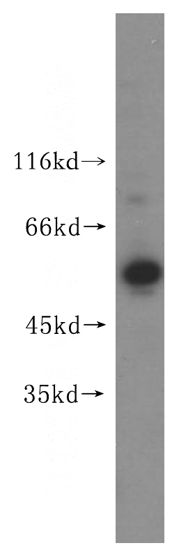 PC-3 cells were subjected to SDS PAGE followed by western blot with Catalog No:116666(UBXN6 antibody) at dilution of 1:1200
