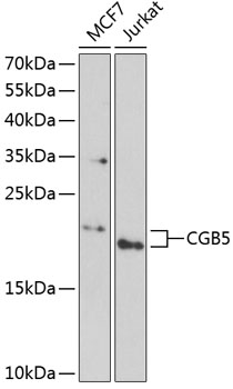 Western blot - CGB5 Polyclonal Antibody 
