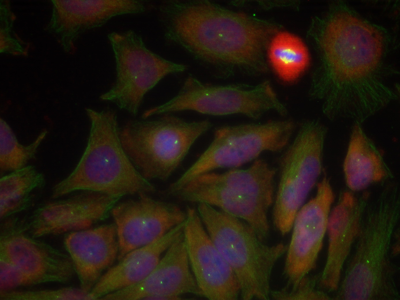 Immunofluorescence staining of methanol-fixed Hela cells using PTEN (Phospho-Ser380/Thr382/Thr383) Antibody .