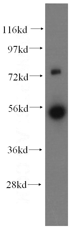 human adrenal gland tissue were subjected to SDS PAGE followed by western blot with Catalog No:110611(FDXR antibody) at dilution of 1:300