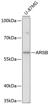 Western blot - ARSB Polyclonal Antibody 