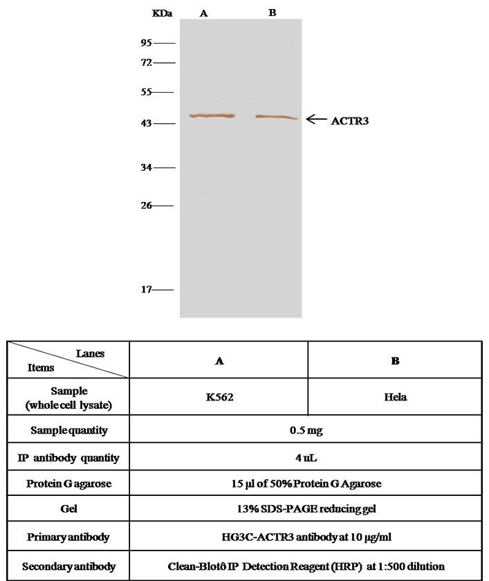 Human ACTR3/Actin-related protein 3 Immunoprecipitation(IP) 15650