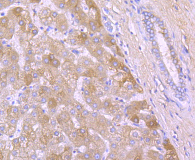 Fig3: Immunohistochemical analysis of paraffin-embedded human liver tissue using anti- A2M antibody. Counter stained with hematoxylin.