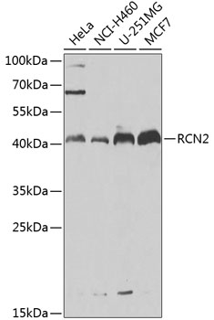 Western blot - RCN2 Polyclonal Antibody 