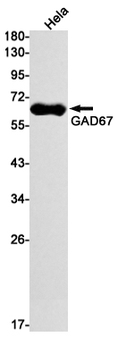 Western blot detection of GAD67 in Hela cell lysates using GAD67 Rabbit mAb(1:1000 diluted).Predicted band size:67kDa.Observed band size:67kDa.