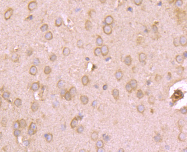 Fig5: Immunohistochemical analysis of paraffin-embedded mouse brain tissue using anti-Kv1.4 antibody. Counter stained with hematoxylin.