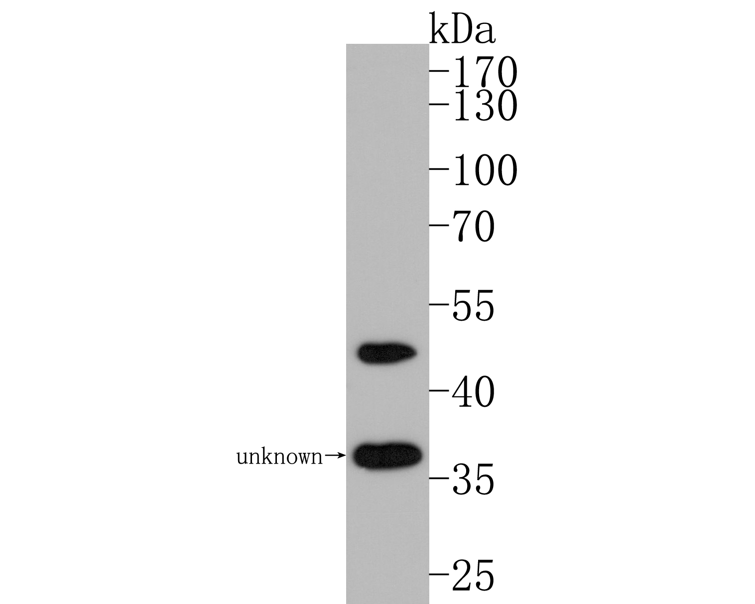 Fig2:; Western blot analysis of Nogo on mouse skeletal muscle tissue lysates. Proteins were transferred to a PVDF membrane and blocked with 5% BSA in PBS for 1 hour at room temperature. The primary antibody ( 1/500) was used in 5% BSA at room temperature for 2 hours. Goat Anti-Rabbit IgG - HRP Secondary Antibody (HA1001) at 1:200,000 dilution was used for 1 hour at room temperature.