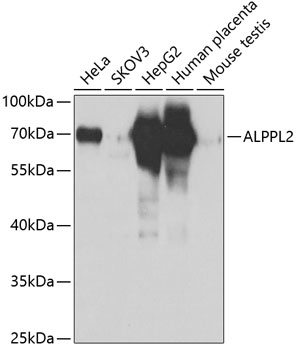 Western blot - ALPPL2 Polyclonal Antibody 