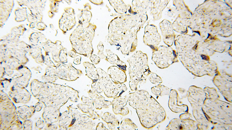 Immunohistochemical of paraffin-embedded human placenta using Catalog No:114276(PRR5 antibody) at dilution of 1:100 (under 10x lens)