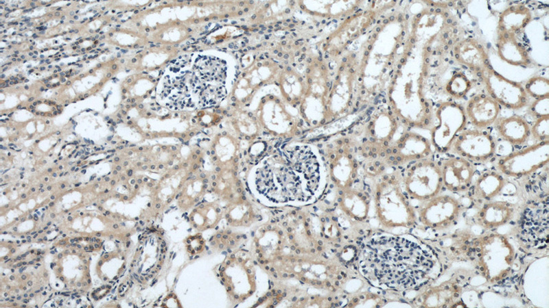 Immunohistochemical of paraffin-embedded human kidney using Catalog No:109359(CNRIP1 antibody) at dilution of 1:50 (under 10x lens)