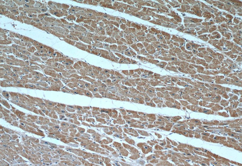 Immunohistochemical of paraffin-embedded human heart using Catalog No:111470(HS3ST1 antibody) at dilution of 1:50 (under 10x lens)