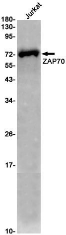 Western blot detection of ZAP70 in Jurkat cell lysates using ZAP70 Rabbit pAb(1:1000 diluted).Predicted band size:70KDa.Observed band size:70KDa.