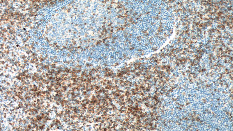 Immunohistochemistry of paraffin-embedded human tonsillitis tissue slide using Catalog No:109065(CD2 Antibody) at dilution of 1:200 (under 10x lens). Heat mediated antigen retrieved with Tris-EDTA buffer, pH9.0