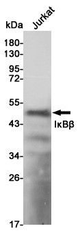 Western blot detection of IκBβ in Jurkat cell lysates using IκBβ mouse mAb (1:1000 diluted).Predicted band size:48KDa.Observed band size:48KDa.