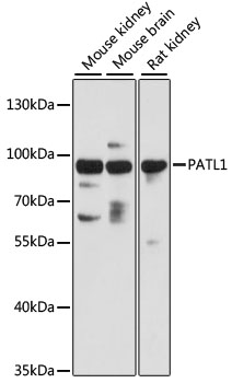 Western blot - PATL1 Polyclonal Antibody 