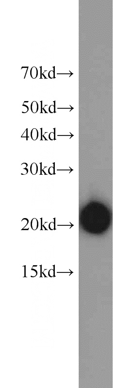 Jurkat cells were subjected to SDS PAGE followed by western blot with Catalog No:108355(ATP5H antibody) at dilution of 1:3000
