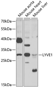 Western blot - LYVE1 Polyclonal Antibody 