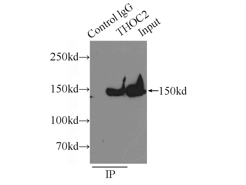 IP Result of anti-THoc2 (IP:Catalog No:116047, 5ug; Detection:Catalog No:116047 1:300) with HeLa cells lysate 1800ug.