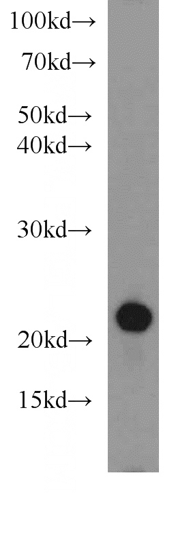 Jurkat cells were subjected to SDS PAGE followed by western blot with Catalog No:109020(CD3E antibody) at dilution of 1:1000