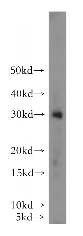 BxPC-3 cells were subjected to SDS PAGE followed by western blot with Catalog No:111853(INS antibody) at dilution of 1:10000