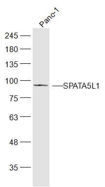 Fig1: Sample:; Panc-1(Human) Cell Lysate at 30 ug; Primary: Anti-SPATA5L1 at 1/300 dilution; Secondary: IRDye800CW Goat Anti-Rabbit IgG at 1/20000 dilution; Predicted band size: 81 kD; Observed band size: 81 kD